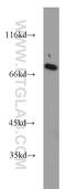 SAS-6 Centriolar Assembly Protein antibody, 21377-1-AP, Proteintech Group, Western Blot image 