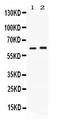 Secretin Receptor antibody, PB10096, Boster Biological Technology, Western Blot image 