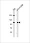 CTD Phosphatase Subunit 1 antibody, 62-370, ProSci, Western Blot image 