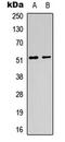 Acetylcholine Receptor antibody, LS-C354618, Lifespan Biosciences, Western Blot image 