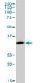 Acyl-CoA Thioesterase 8 antibody, H00010005-M03, Novus Biologicals, Western Blot image 