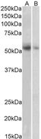 Solute Carrier Family 18 Member A2 antibody, LS-B15179, Lifespan Biosciences, Western Blot image 