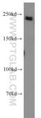 SPT6 Homolog, Histone Chaperone And Transcription Elongation Factor antibody, 23073-1-AP, Proteintech Group, Western Blot image 