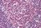 Spi-1 Proto-Oncogene antibody, GTX88620, GeneTex, Immunohistochemistry paraffin image 