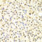 Damage Specific DNA Binding Protein 2 antibody, LS-C331725, Lifespan Biosciences, Immunohistochemistry paraffin image 