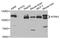 Neurotrophic Receptor Tyrosine Kinase 3 antibody, STJ28405, St John