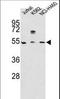 Apolipoprotein A4 antibody, LS-C100226, Lifespan Biosciences, Western Blot image 