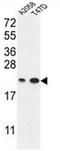 Abhydrolase Domain Containing 14B antibody, AP50029PU-N, Origene, Western Blot image 