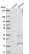 Zinc Finger DHHC-Type Containing 4 antibody, PA5-56936, Invitrogen Antibodies, Western Blot image 