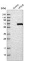Vacuolar Protein Sorting 45 Homolog antibody, HPA027425, Atlas Antibodies, Western Blot image 