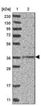DNA Replication And Sister Chromatid Cohesion 1 antibody, PA5-54885, Invitrogen Antibodies, Western Blot image 