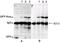 Non-receptor tyrosine-protein kinase TNK1 antibody, NB300-237, Novus Biologicals, Western Blot image 