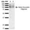 Synuclein Alpha antibody, LS-C773125, Lifespan Biosciences, Western Blot image 