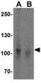 NLR Family Pyrin Domain Containing 7 antibody, GTX85156, GeneTex, Western Blot image 