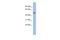 Small Nuclear RNA Activating Complex Polypeptide 3 antibody, A12529, Boster Biological Technology, Western Blot image 