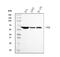 Pyruvate Kinase M1/2 antibody, M01173-1, Boster Biological Technology, Western Blot image 