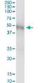 Galactosidase Alpha antibody, H00002717-B01P, Novus Biologicals, Western Blot image 