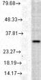 Heme Oxygenase 1 antibody, TA326355, Origene, Western Blot image 