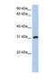 Dickkopf Like Acrosomal Protein 1 antibody, NBP1-69688, Novus Biologicals, Western Blot image 