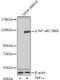 Nuclear Factor Kappa B Subunit 2 antibody, GTX54550, GeneTex, Western Blot image 