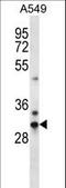 CMT1A Duplicated Region Transcript 15 Like 2 antibody, LS-C203650, Lifespan Biosciences, Western Blot image 