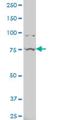 Ubiquitin Specific Peptidase 51 antibody, H00158880-A01, Novus Biologicals, Western Blot image 