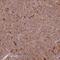 C2 Calcium Dependent Domain Containing 4B antibody, NBP1-94053, Novus Biologicals, Immunohistochemistry frozen image 