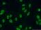 SAP domain-containing ribonucleoprotein antibody, 15798-1-AP, Proteintech Group, Immunofluorescence image 