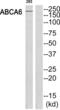 ATP Binding Cassette Subfamily A Member 6 antibody, abx014227, Abbexa, Western Blot image 