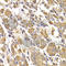 Methyltransferase Like 7B antibody, A7200, ABclonal Technology, Immunohistochemistry paraffin image 