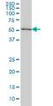 Splicing Factor 3a Subunit 2 antibody, H00008175-M01, Novus Biologicals, Western Blot image 