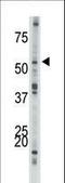 Activin A Receptor Type 1B antibody, LS-C97141, Lifespan Biosciences, Western Blot image 