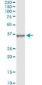 Dehydrogenase/Reductase 9 antibody, H00010170-M06, Novus Biologicals, Immunoprecipitation image 