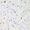 Activin A Receptor Type 2A antibody, 18-428, ProSci, Immunohistochemistry paraffin image 