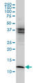 Cystatin-beta antibody, LS-B6073, Lifespan Biosciences, Western Blot image 
