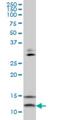 VAMP1 antibody, H00006843-M02, Novus Biologicals, Western Blot image 