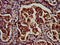 Regulatory Factor X1 antibody, CSB-PA019610LA01HU, Cusabio, Immunohistochemistry paraffin image 