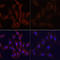 Microtubule Associated Protein 1 Light Chain 3 Beta antibody, LS-C750554, Lifespan Biosciences, Immunofluorescence image 
