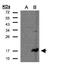 CD247 Molecule antibody, GTX108479, GeneTex, Western Blot image 