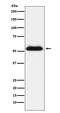 Transmembrane Serine Protease 2 antibody, M00666, Boster Biological Technology, Western Blot image 