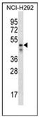 Na(+)/H(+) exchange regulatory cofactor NHE-RF3 antibody, AP53250PU-N, Origene, Western Blot image 