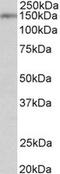 Synaptic Ras GTPase Activating Protein 1 antibody, TA309527, Origene, Western Blot image 