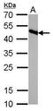 Isocitrate Dehydrogenase (NADP(+)) 2, Mitochondrial antibody, GTX628487, GeneTex, Western Blot image 