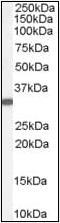 Voltage Dependent Anion Channel 2 antibody, orb88133, Biorbyt, Western Blot image 