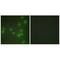 Zinc Finger RANBP2-Type Containing 2 antibody, A07103, Boster Biological Technology, Immunohistochemistry frozen image 