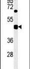 SH2 Domain Containing 2A antibody, PA5-25250, Invitrogen Antibodies, Western Blot image 