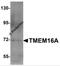 Anoctamin 1 antibody, 5419, ProSci, Western Blot image 