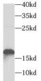 Troponin C2, Fast Skeletal Type antibody, FNab08836, FineTest, Western Blot image 