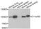 EMSY Transcriptional Repressor, BRCA2 Interacting antibody, A04477, Boster Biological Technology, Western Blot image 