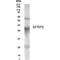 Secreted frizzled-related protein 5 antibody, GTX70353, GeneTex, Western Blot image 